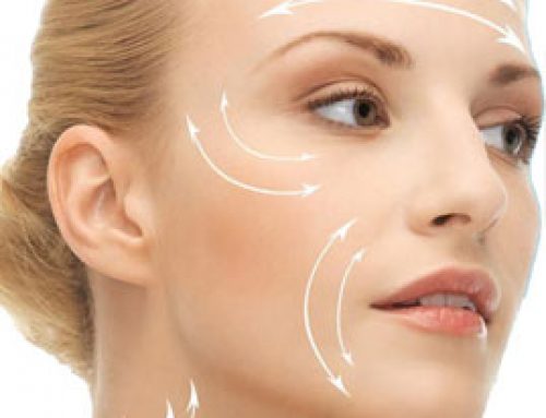 What is the right age for a face lift?