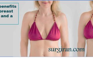 What are the benefits of combining breast augmentation and a breast lift?