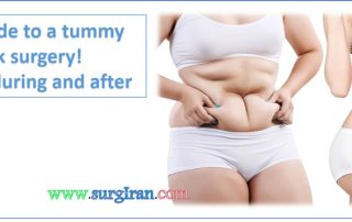 tummy tuck surgery