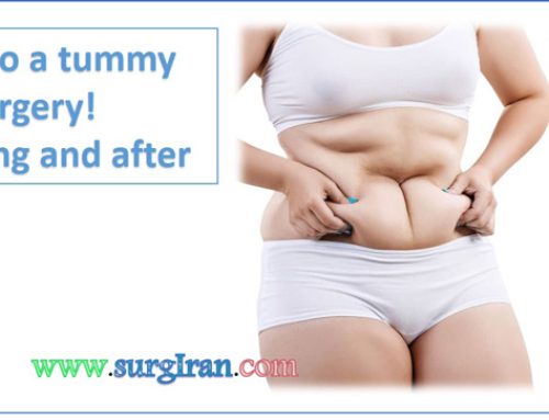 Your guide to a tummy tuck surgery – before, during and after
