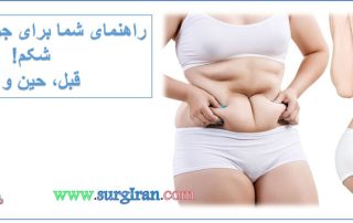 جراحی زیبایی شکم